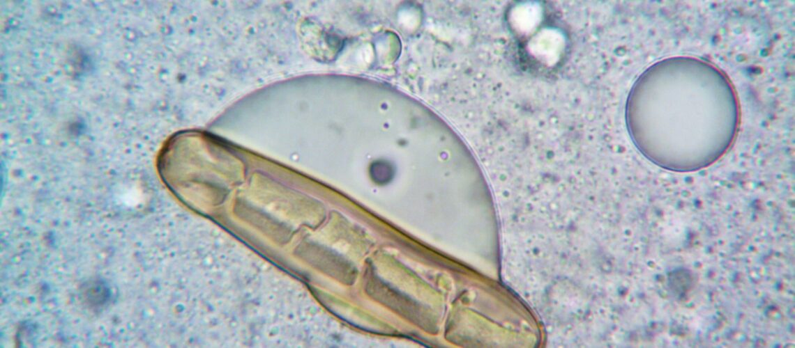 Extreme close-up of a spore and cell structures observed under a microscope, highlighting intricate biology details.