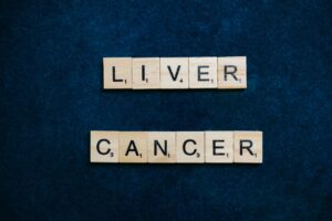 Cancer du foie : causes, symptômes, diagnostic et traitements