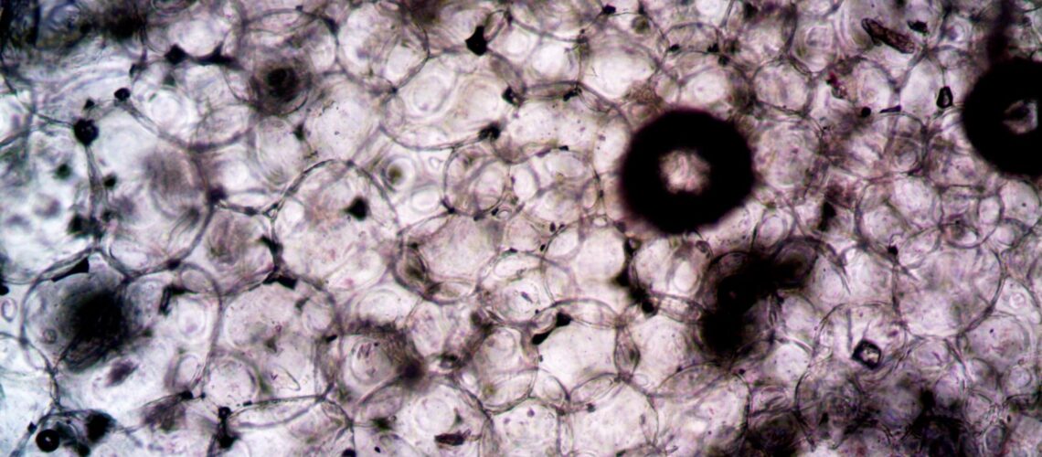 Microscopic image showcasing the intricate structure and texture of plant cells.