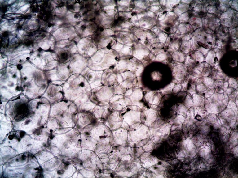 Candida albicans : pronostic, évolution et facteurs déterminants