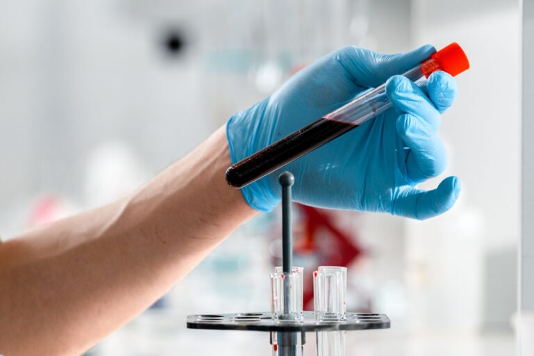 Cholestérol sanguin : comprendre, prévenir et équilibrer son taux