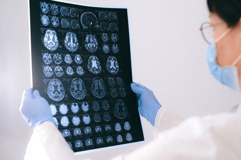 Complications cérébrales du vieillissement : les nouveautés médicales qui changent la donne