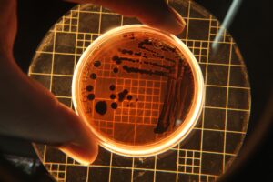Escherichia coli (E. coli) : comprendre cette bactérie et ses dangers