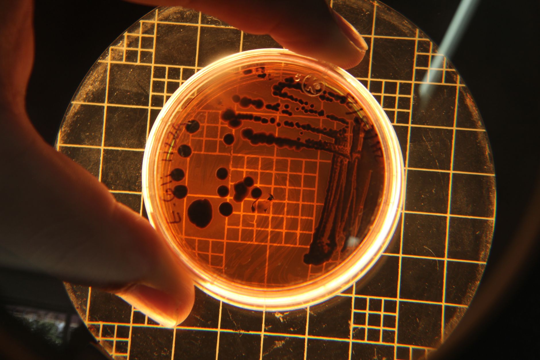 Escherichia coli (E. coli) : comprendre cette bactérie et ses dangers