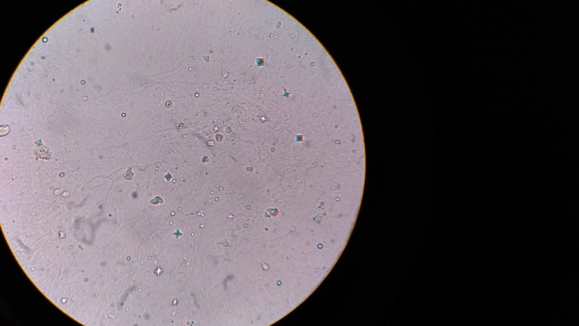 Escherichia coli (E. coli) : tout comprendre sur cette bactérie