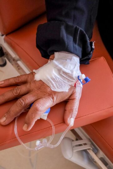 Close-up of a patient's hand receiving chemotherapy treatment in a medical facility.