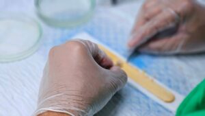 La greffe d'organe : tout comprendre sur cette prouesse médicale