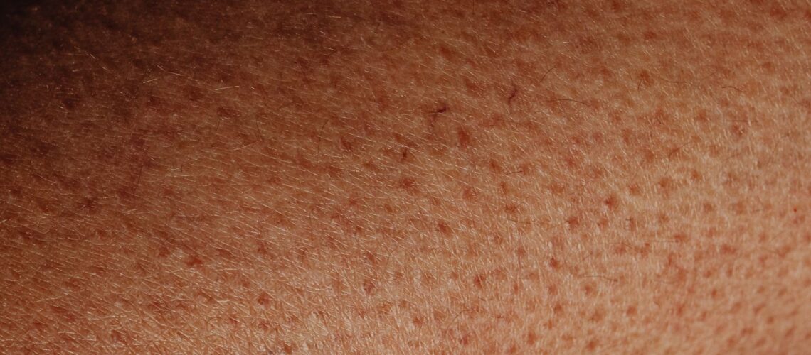Detailed close-up view of human skin surface showing natural texture and imperfections.