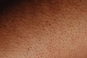 La peau et ses couches : comprendre l'anatomie du plus grand organe du corps humain