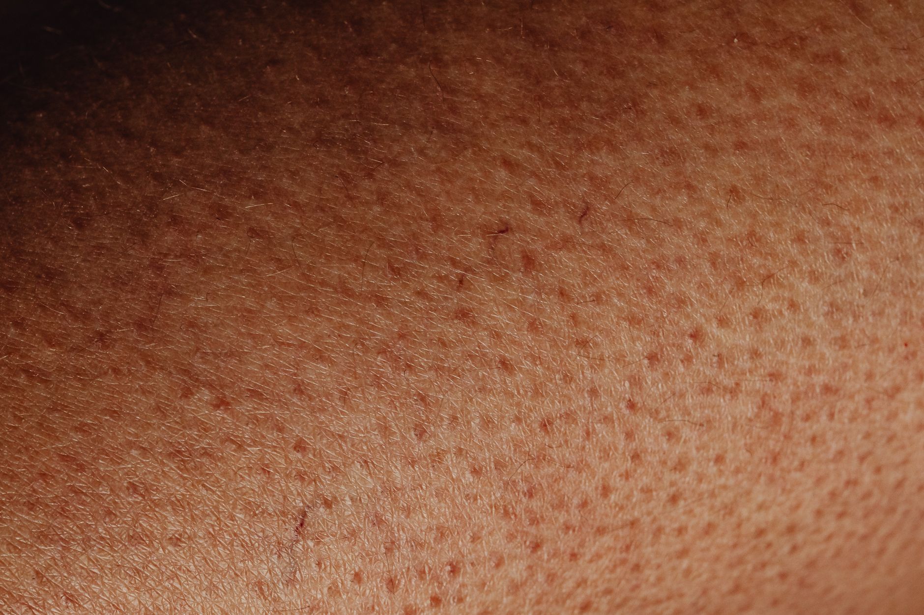 La peau et ses couches : comprendre l’anatomie du plus grand organe du corps humain