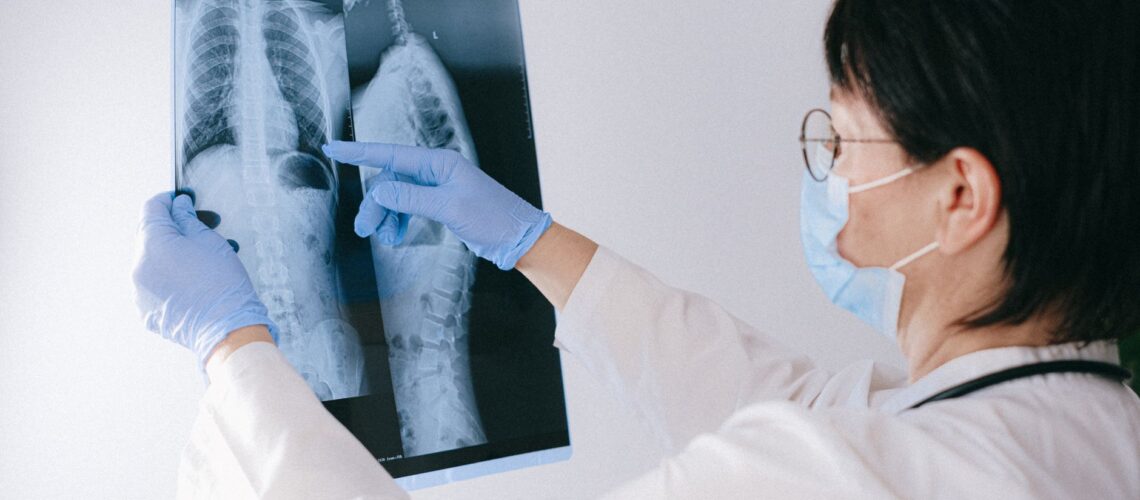 Medical professional reviewing an X-ray, emphasizing healthcare diagnosis and examination.