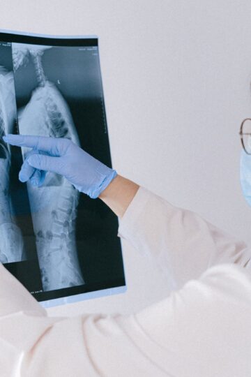 Medical professional reviewing an X-ray, emphasizing healthcare diagnosis and examination.