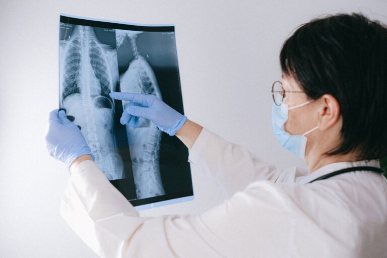 La pneumonie : causes, symptômes, traitements et prévention