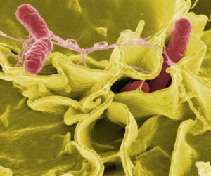 La salmonellose : causes, symptômes, traitement et prévention