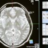 Intricate MRI brain scan displayed on a computer screen for medical analysis and diagnosis.