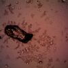 Close-up of bacteria and crystal formations under a microscope, displaying intricate patterns.