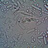 Close-up image of rod-shaped bacteria under a microscope, showcasing microscopic detail.