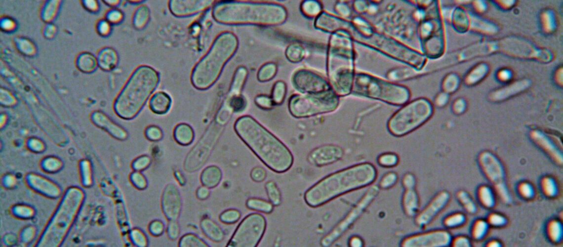 Close-up image of rod-shaped bacteria under a microscope, showcasing microscopic detail.