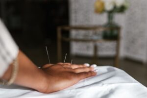 L'acupuncture : principes, indications et efficacité