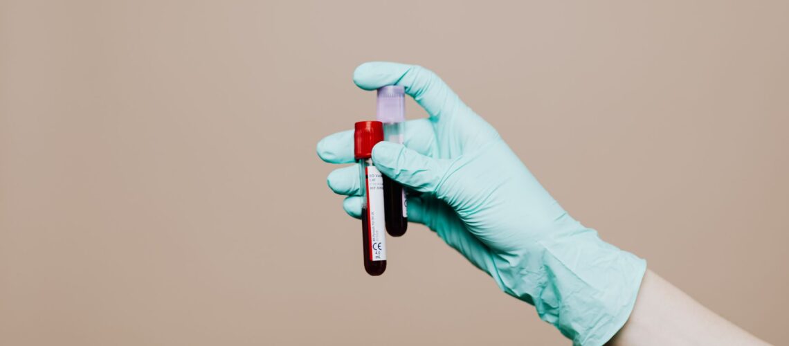 Close-up of a gloved hand holding blood test tubes against neutral background.