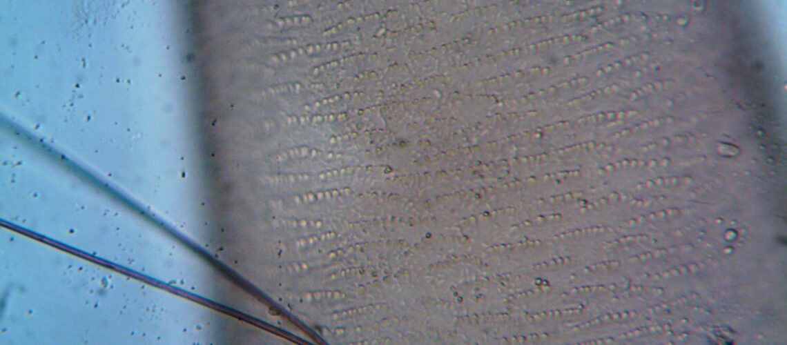 Close-up image of hair follicle under a microscope, showing cellular structures.