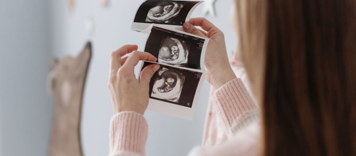 A pregnant woman looks at ultrasound images, showcasing her baby's development. Perfect for healthcare and pregnancy themes.