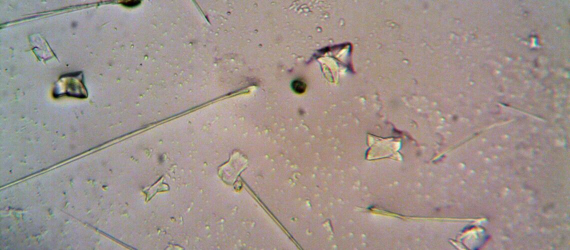Detailed view of various particles under a microscope, showcasing shapes and textures.