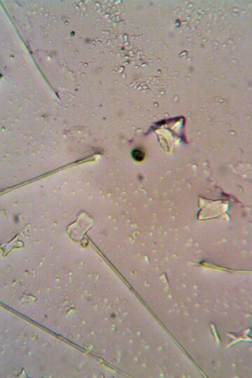 Detailed view of various particles under a microscope, showcasing shapes and textures.
