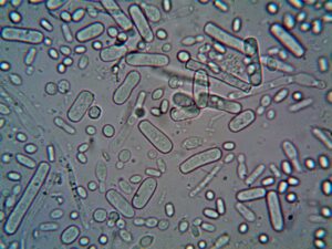 Le streptocoque : tout comprendre sur cette bactérie et ses infections