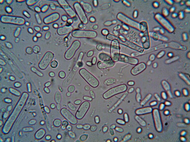 Le streptocoque : tout comprendre sur cette bactérie et ses infections