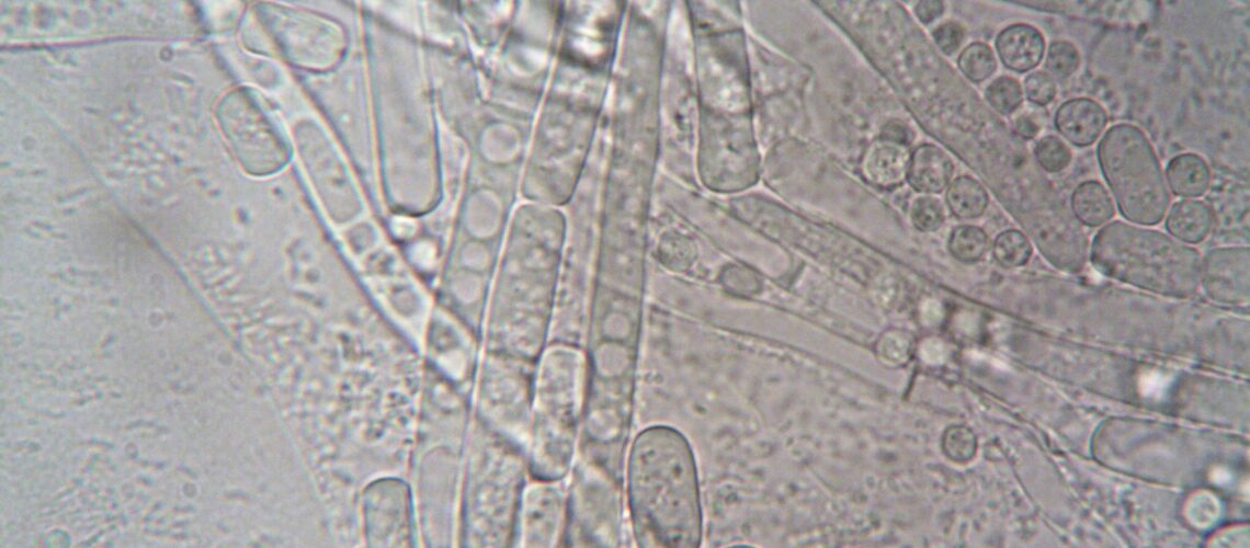 Close-up image of fungal hyphae under microscope showcasing biological structures.