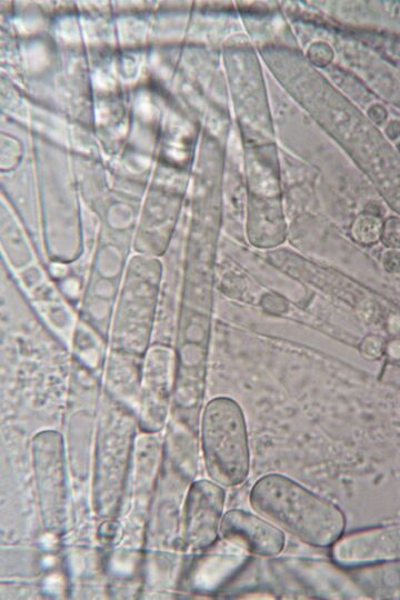 Close-up image of fungal hyphae under microscope showcasing biological structures.
