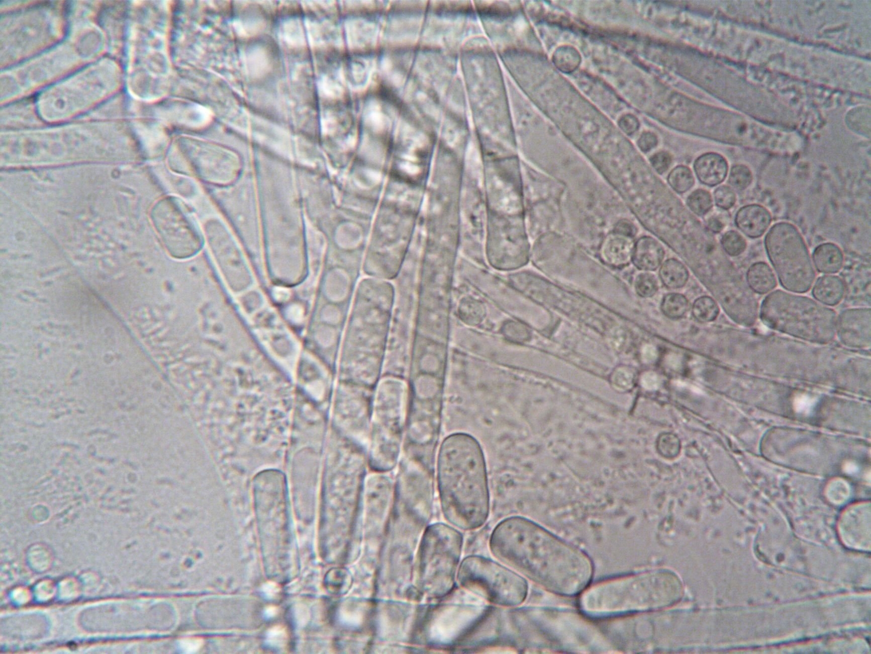 Le streptocoque : tout savoir sur cette bactérie et ses infections