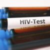 A detailed close-up image showing blood samples labeled for HIV testing.