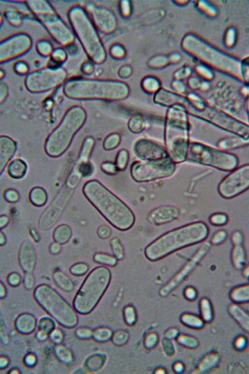 Close-up image of rod-shaped bacteria under a microscope, showcasing microscopic detail.
