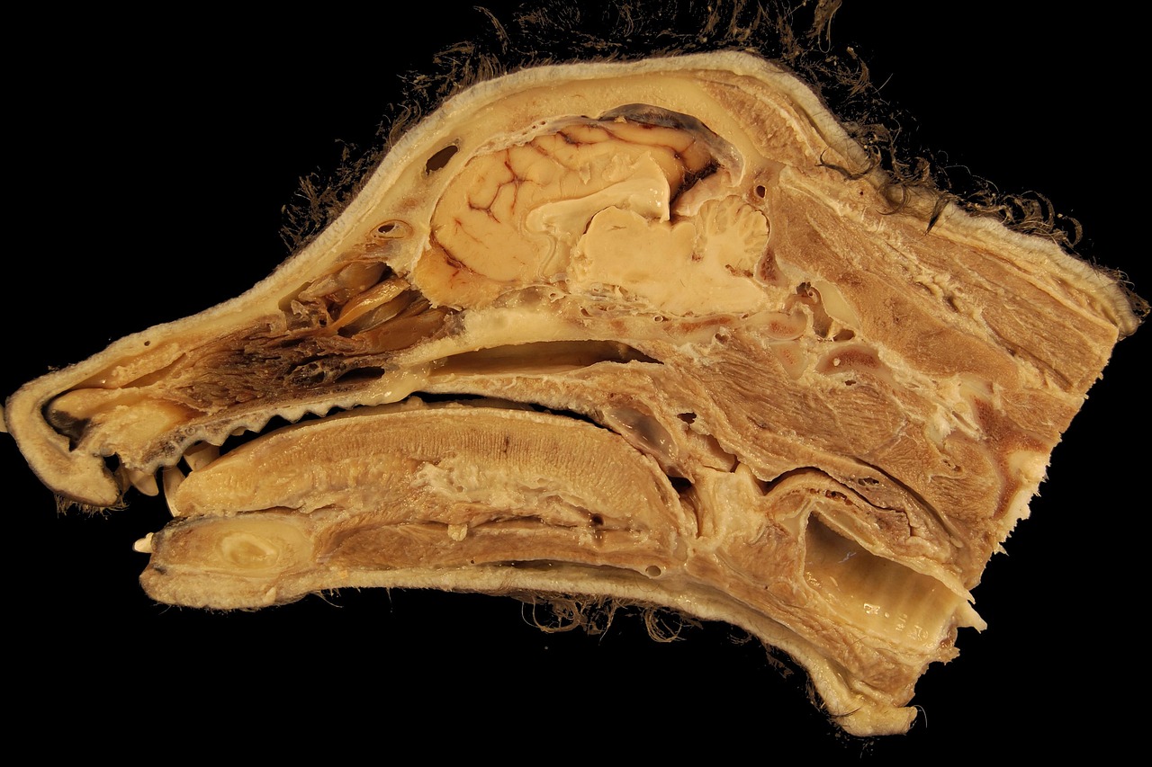 Les cornets nasaux : anatomie, fonctions et pathologies