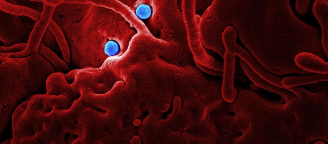 Detailed microscopic image showing red structures and blue virus particles.