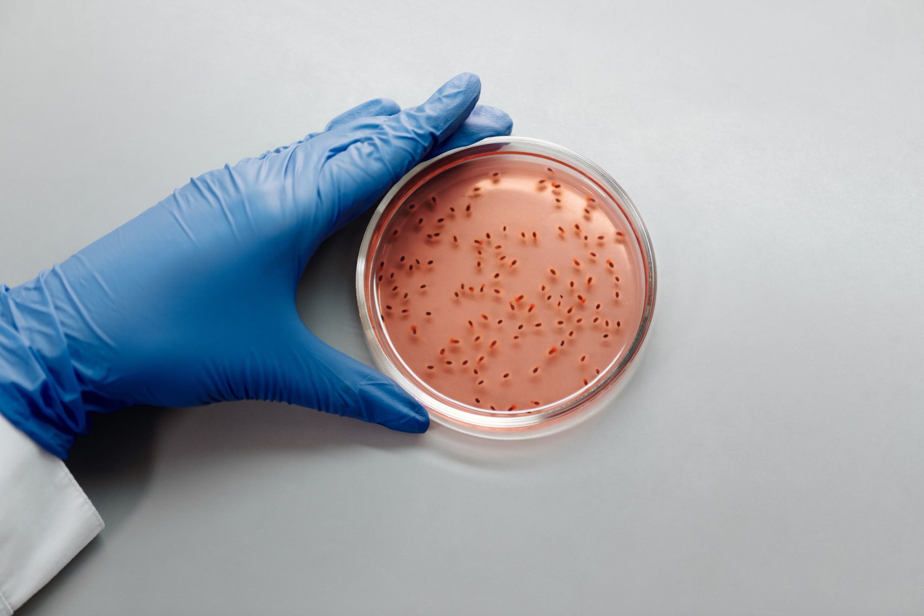 Listeria monocytogenes : comprendre la bactérie et prévenir la listériose