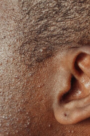 Detailed close-up image highlighting the texture of human skin and ear.