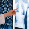 A doctor pointing at a chest X-ray among MRI scans in a medical clinic.
