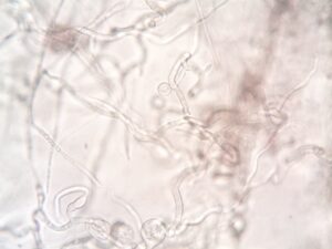 Microsporum : comprendre ce champignon dermatophyte responsable des teignes