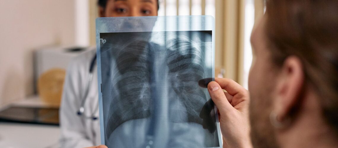 Doctor reviews chest x-ray results with patient in a medical office.