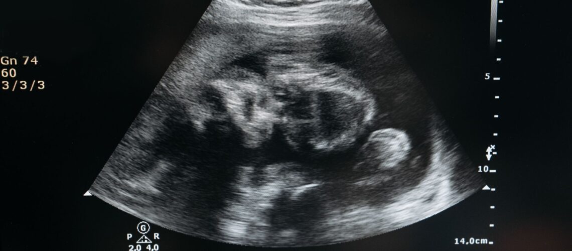 Ultrasound scan showing the image of an unborn child in the womb, highlighting pregnancy and healthcare.