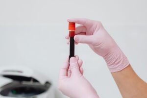 Acides gras saturés : diagnostic, taux sanguins et impact sur la santé
