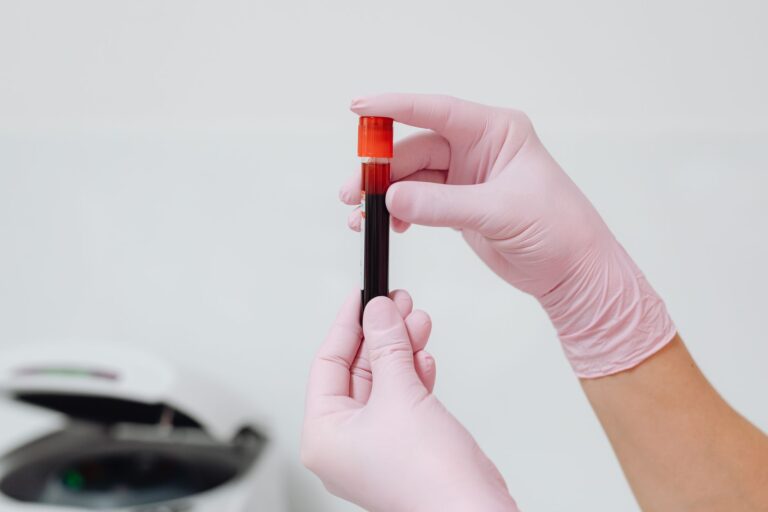Acides gras saturés : diagnostic, taux sanguins et impact sur la santé