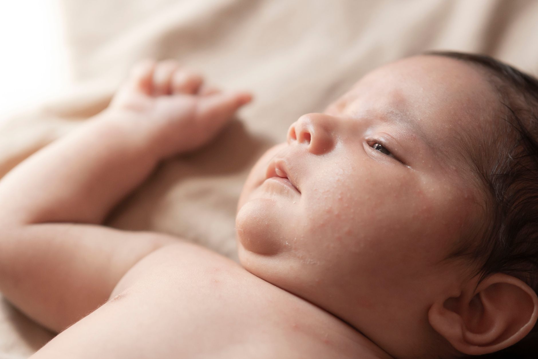 Acné du nouveau-né : causes, symptômes et traitements efficaces