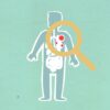 Paper cutout of man under magnifying glass with red viruses spreading on internal organs on green background during disease propagation