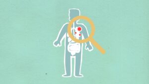 Adénovirus : comprendre ce virus, ses symptômes et les moyens de s'en protéger