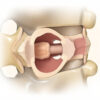 Anneau fibreux : anatomie, rôle et pathologies du disque intervertébral