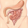 Appendice vermiforme : anatomie, fonctions et pathologies